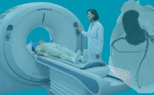 angio-tc-cardiaca-doentes-adultos-28092024 angio-tc-cardiaca-doentes-adultos-28092024